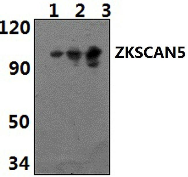 ZFP95 Antibody in Western Blot (WB)