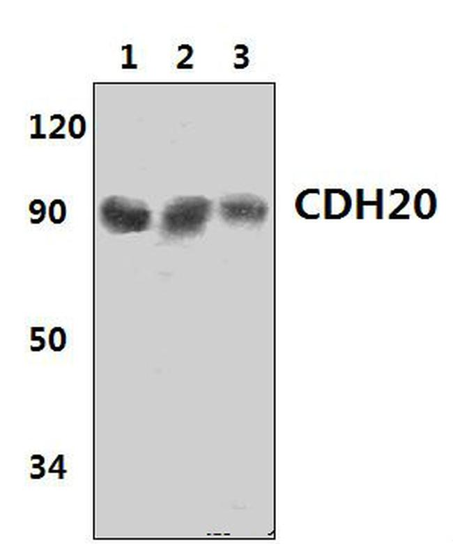 CDH20 Antibody in Western Blot (WB)