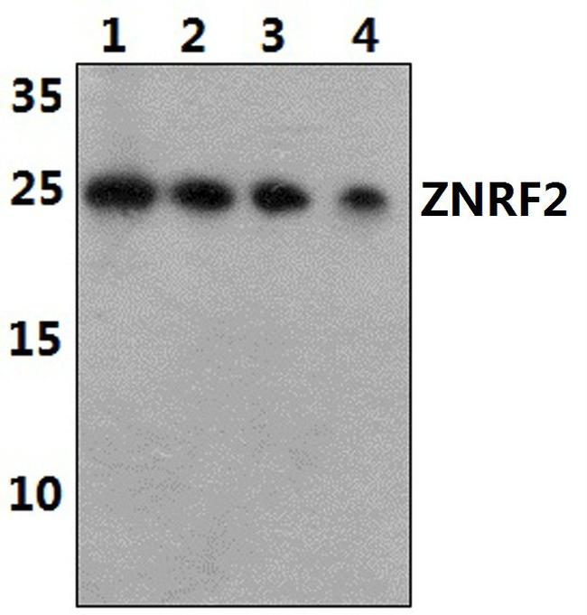ZNRF2 Antibody in Western Blot (WB)