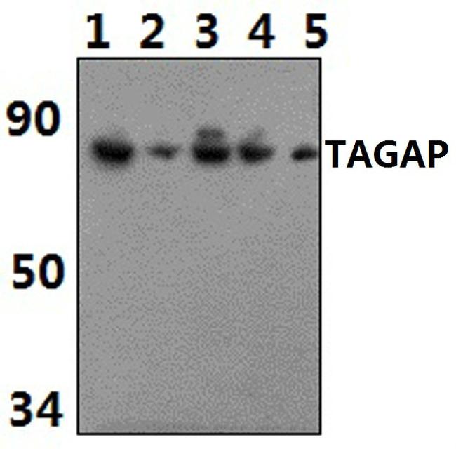 TAGAP Antibody in Western Blot (WB)