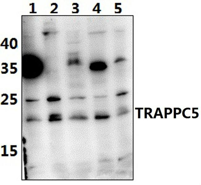 TRAPPC5 Antibody in Western Blot (WB)