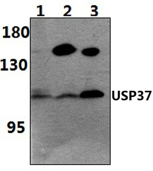 USP37 Antibody in Western Blot (WB)
