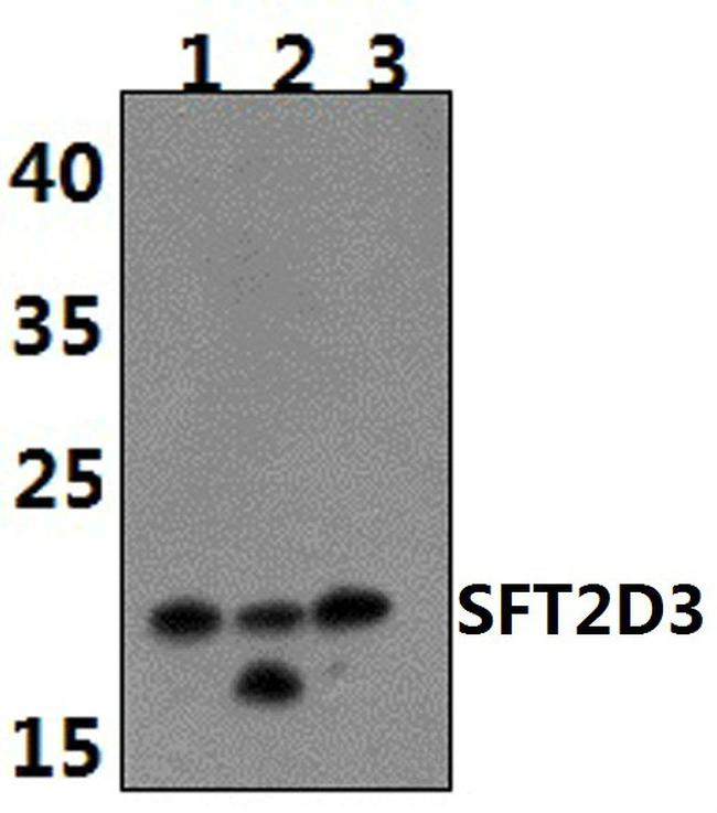 SFT2D3 Antibody in Western Blot (WB)