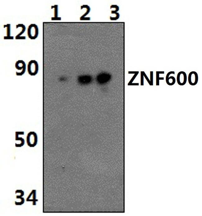 ZNF600 Antibody in Western Blot (WB)