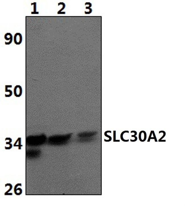 SLC30A2 Antibody in Western Blot (WB)