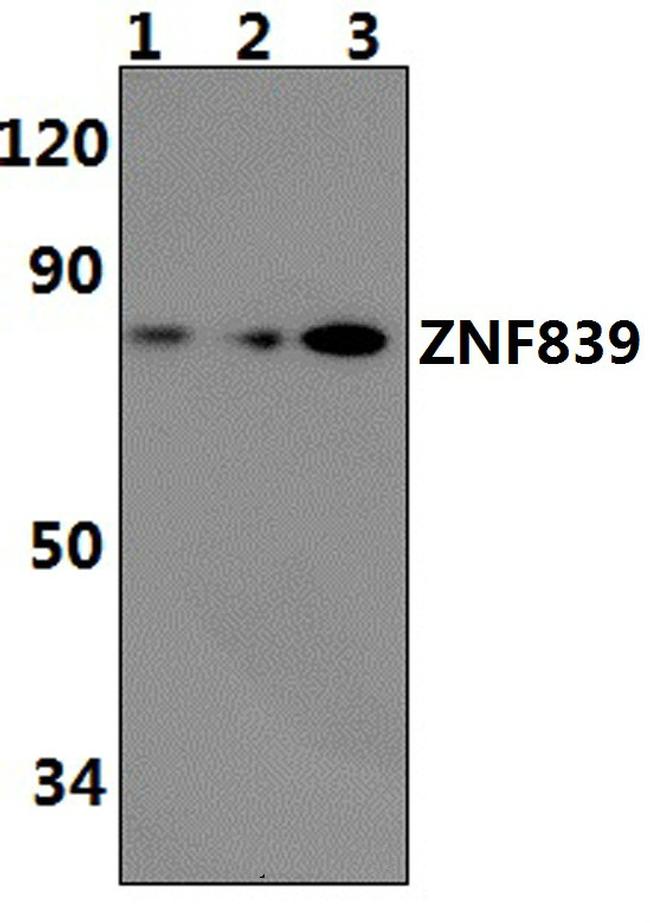 ZNF839 Antibody in Western Blot (WB)