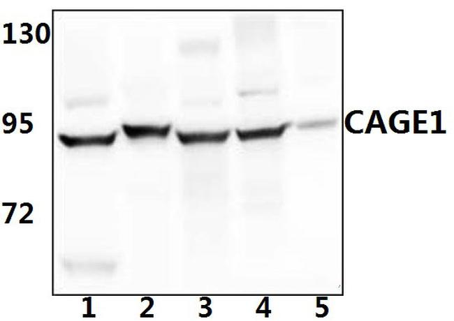 CAGE1 Antibody in Western Blot (WB)