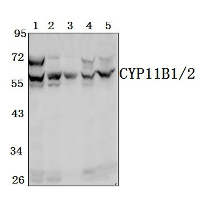 CYP11B1/CYP11B2 Antibody in Western Blot (WB)