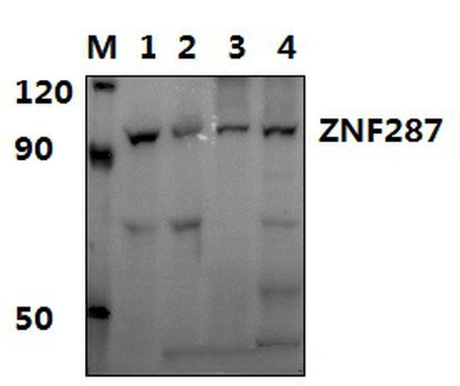 ZNF287 Antibody in Western Blot (WB)