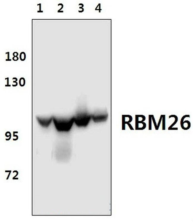 RBM26 Antibody in Western Blot (WB)