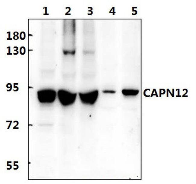 Calpain 12 Antibody in Western Blot (WB)