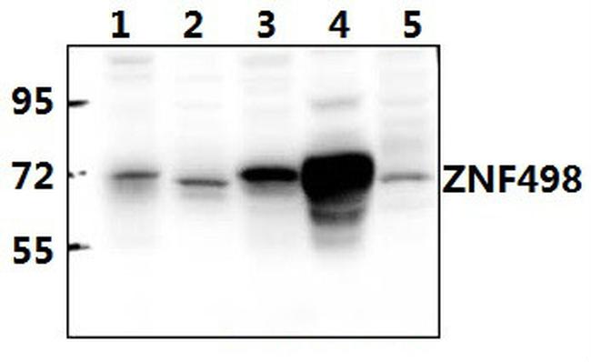 ZNF498 Antibody in Western Blot (WB)