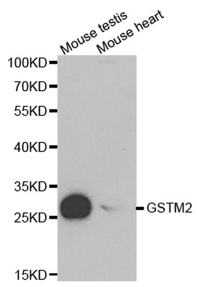 GSTM2 Antibody in Western Blot (WB)