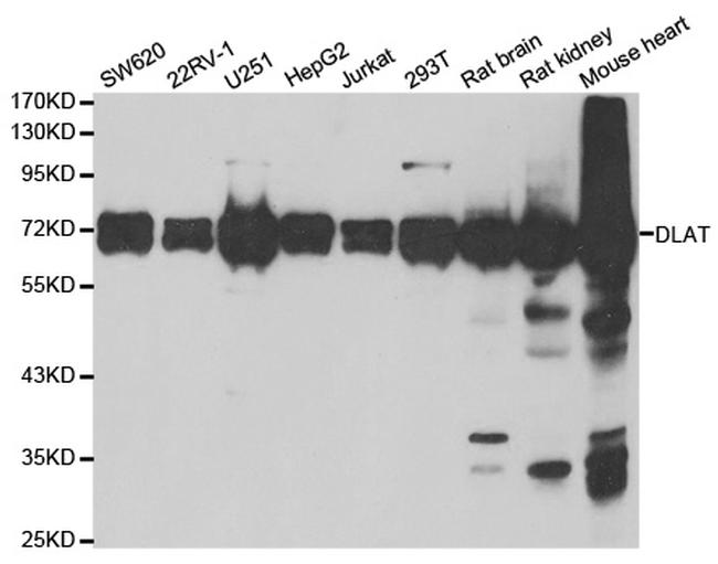 DLAT Antibody in Western Blot (WB)