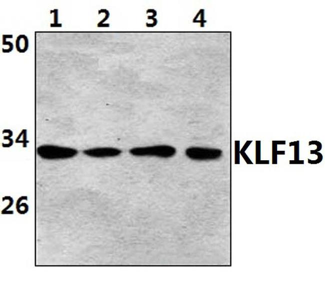 Acetyl-RFLAT-1 (Lys166) Antibody in Western Blot (WB)