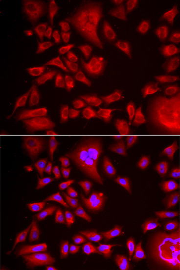BLMH Antibody in Immunocytochemistry (ICC/IF)
