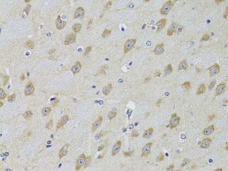 GRK3 Antibody in Immunohistochemistry (Paraffin) (IHC (P))