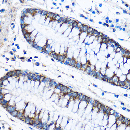 CAPZA2 Antibody in Immunohistochemistry (Paraffin) (IHC (P))