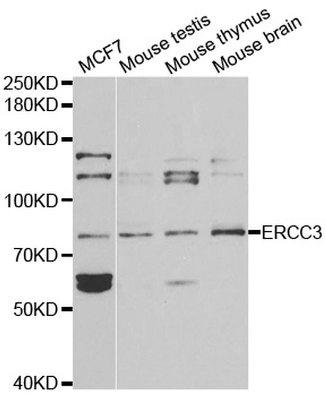 XPB Antibody in Western Blot (WB)