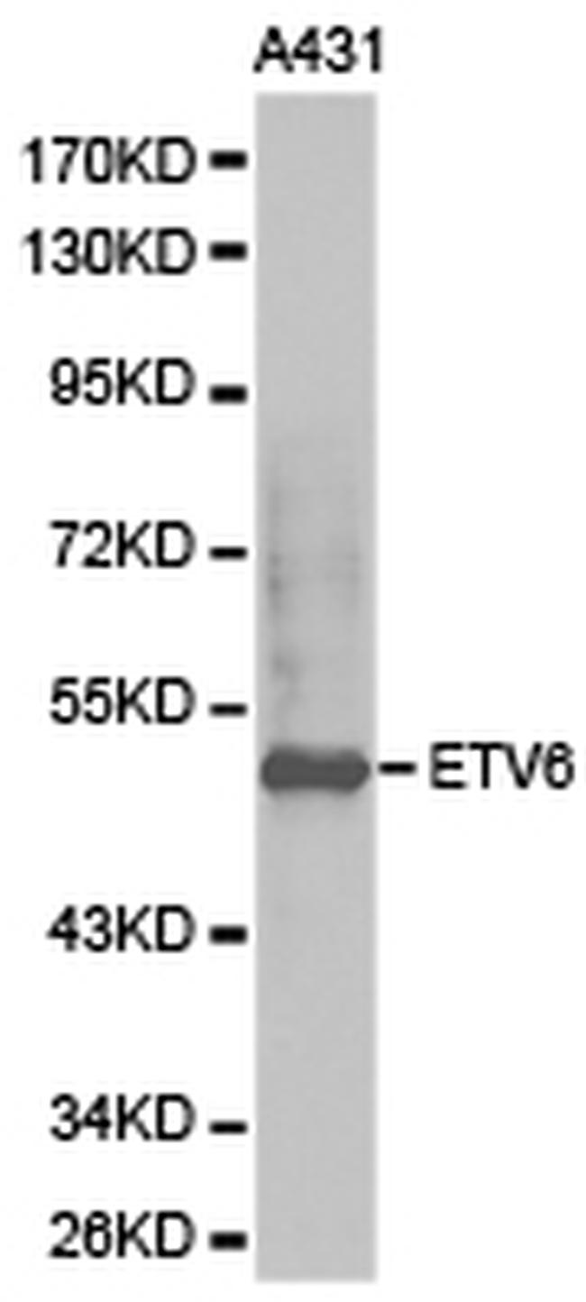 ETV6 Antibody in Western Blot (WB)