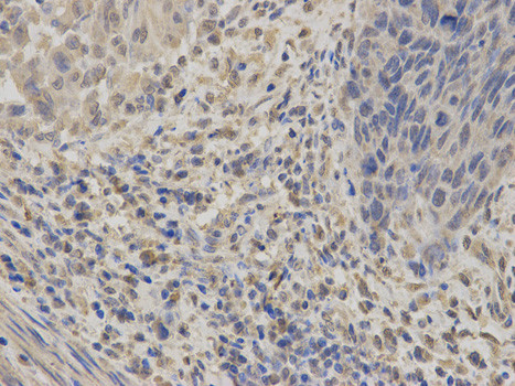 GABRA2 Antibody in Immunohistochemistry (Paraffin) (IHC (P))