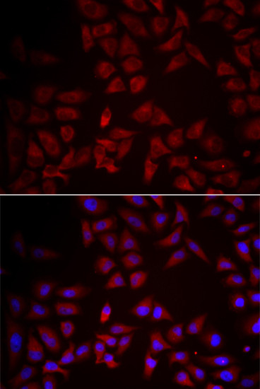 TECK Antibody in Immunocytochemistry (ICC/IF)