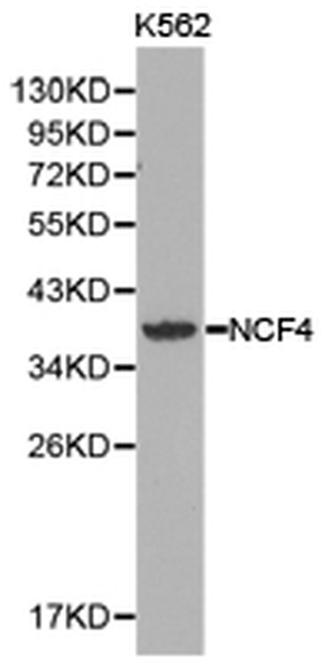 NCF4 Antibody in Western Blot (WB)