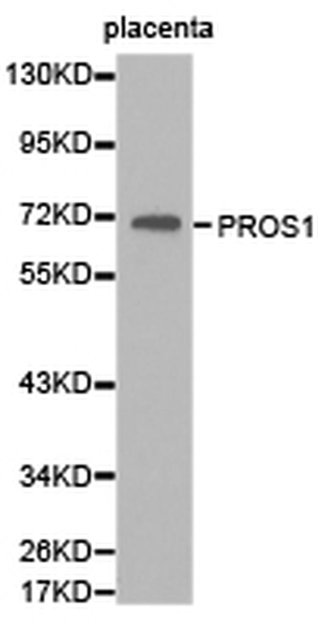 Protein S Antibody in Western Blot (WB)
