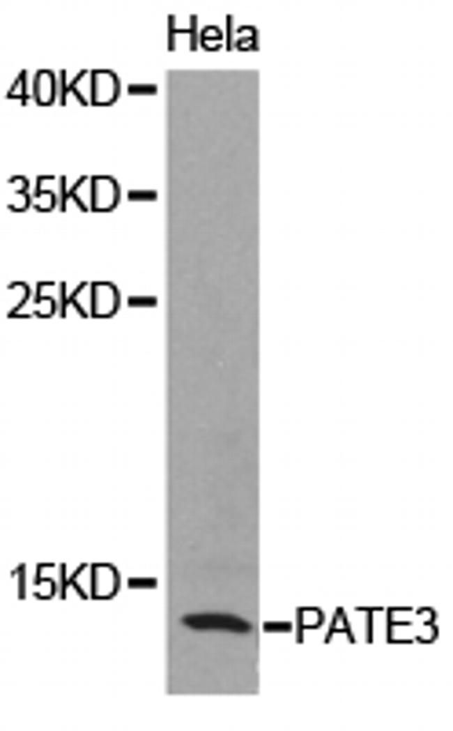 PATE3 Antibody in Western Blot (WB)