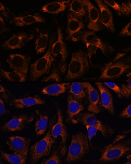 TCP-1 gamma Antibody in Immunocytochemistry (ICC/IF)