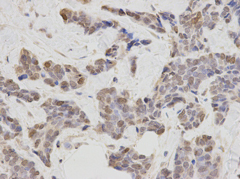 PLCB1 Antibody in Immunohistochemistry (Paraffin) (IHC (P))