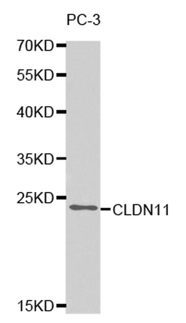 Claudin 11 Antibody in Western Blot (WB)