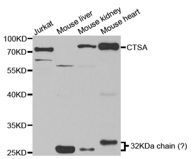 Cathepsin A Antibody in Western Blot (WB)