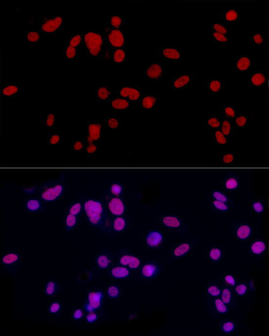 CREM Antibody in Immunocytochemistry (ICC/IF)