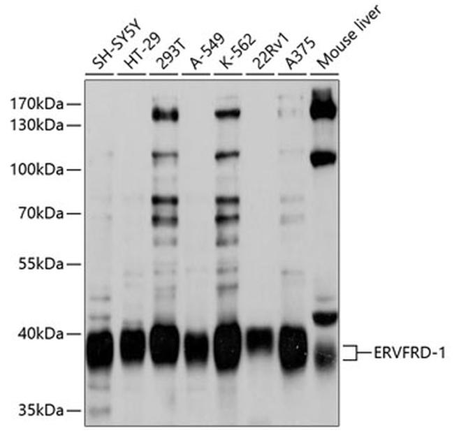 HERV-FRD Antibody in Western Blot (WB)