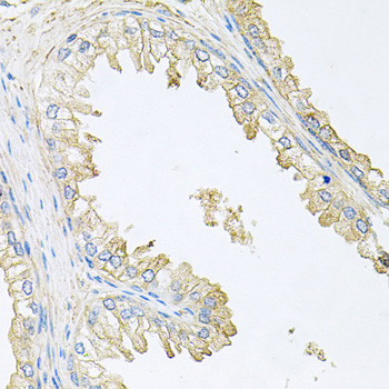 Calcineurin B Antibody in Immunohistochemistry (Paraffin) (IHC (P))