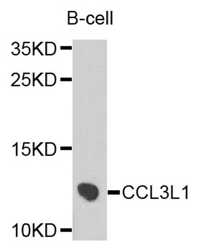 CCL3L1 Antibody in Western Blot (WB)