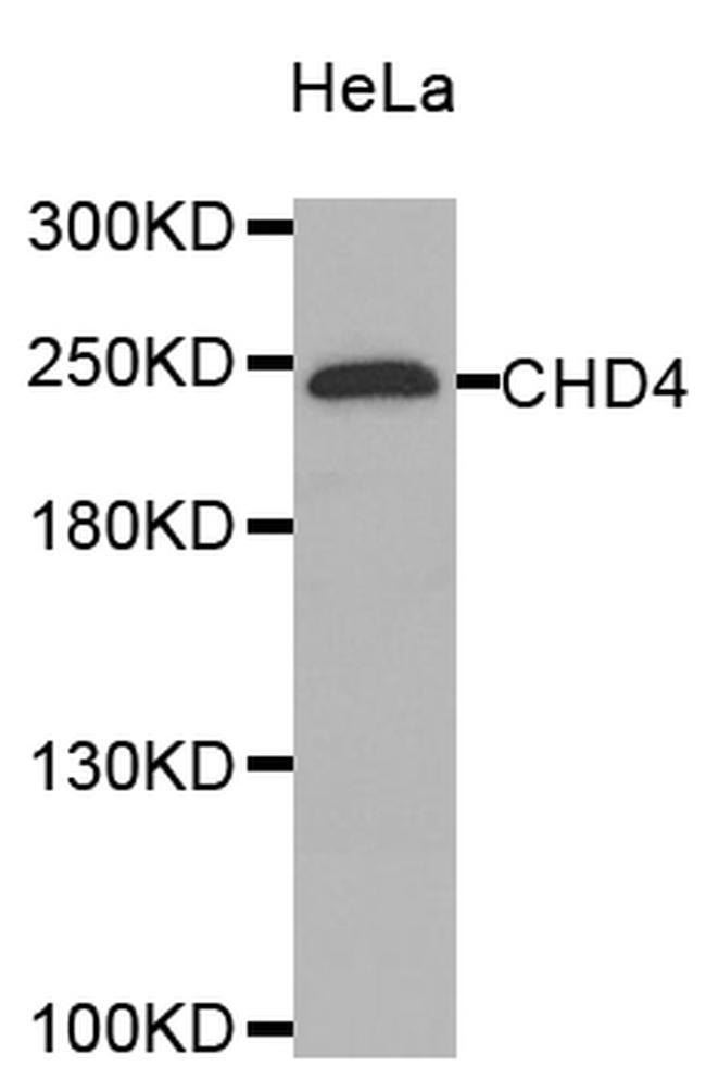 CHD4 Antibody in Western Blot (WB)