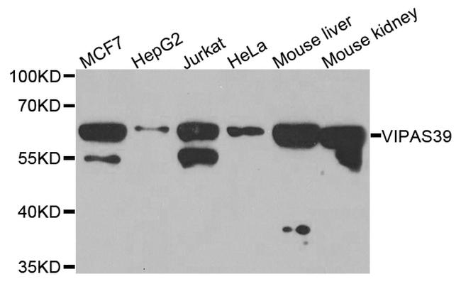 VIPAS39 Antibody in Western Blot (WB)
