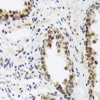 SAFB2 Antibody in Immunohistochemistry (Paraffin) (IHC (P))