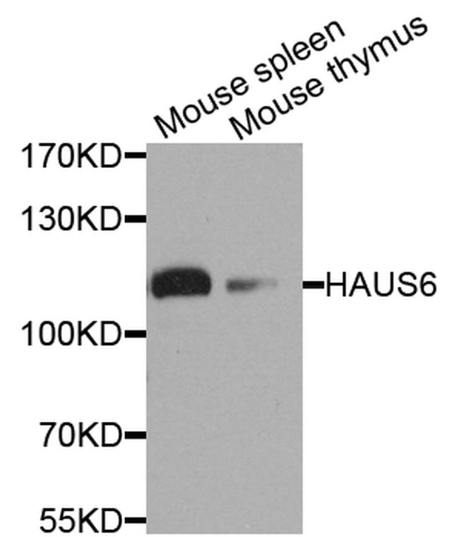 HAUS6 Antibody in Western Blot (WB)