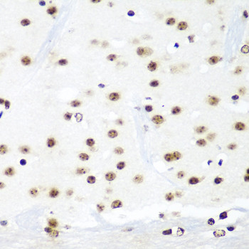 HTATSF1 Antibody in Immunohistochemistry (Paraffin) (IHC (P))