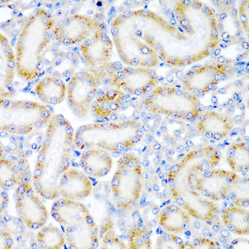WRB Antibody in Immunohistochemistry (Paraffin) (IHC (P))