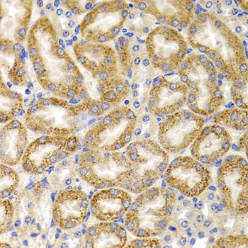 BMP-15 Antibody in Immunohistochemistry (Paraffin) (IHC (P))