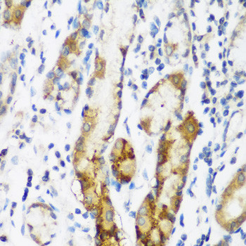 NAT15 Antibody in Immunohistochemistry (Paraffin) (IHC (P))