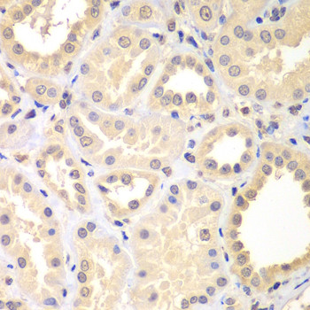 SPIN2 Antibody in Immunohistochemistry (Paraffin) (IHC (P))