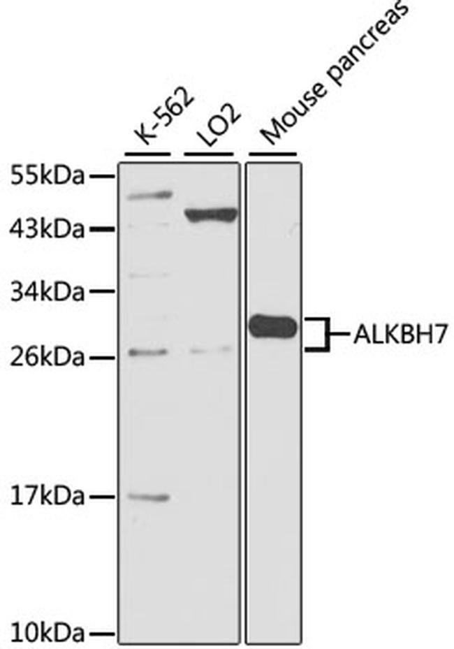 ALKBH7 Antibody in Western Blot (WB)