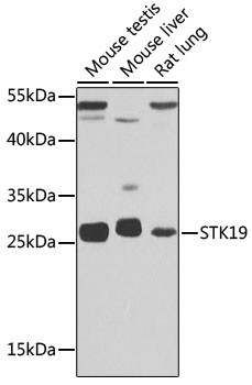 STK19 Antibody in Western Blot (WB)