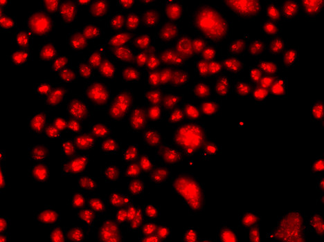 FANCM Antibody in Immunocytochemistry (ICC/IF)