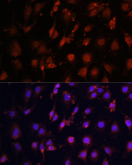 TET3 Antibody in Immunocytochemistry (ICC/IF)